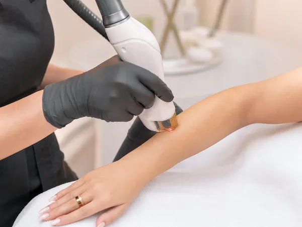 Laser Elite iQ Cynosure au salon Chez Coco, Ahuntsic